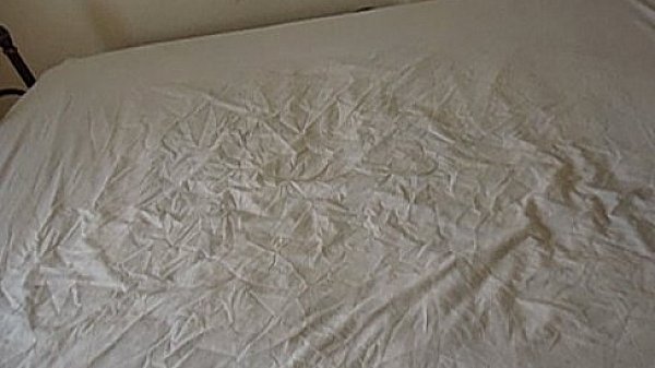 bed wetting for Hannah